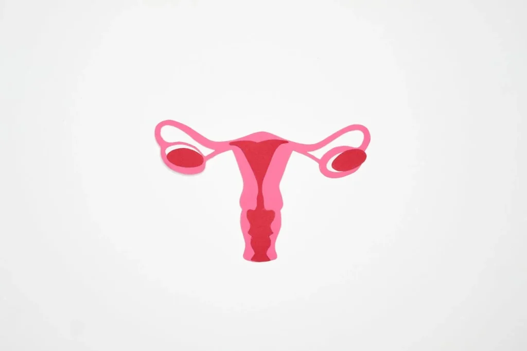 Polycystic Ovary Syndrome